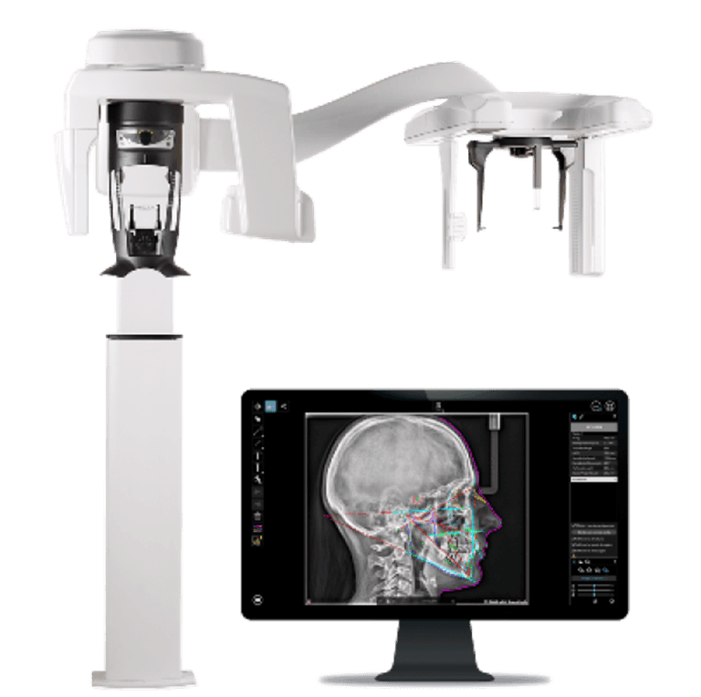 dentascan , cefalometria